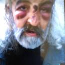 3 029 лв. са нужни за дископатийна операция на Венци 