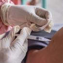 В СРЗИ отново се организира безплатна имунизация срещу морбили, паротит и рубеола